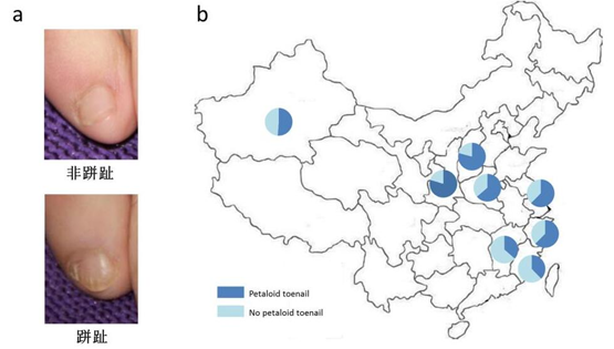 中國科學(xué)院上海營(yíng)養與健康研究院科研人員發(fā)現跰趾特征非漢族群體所獨有