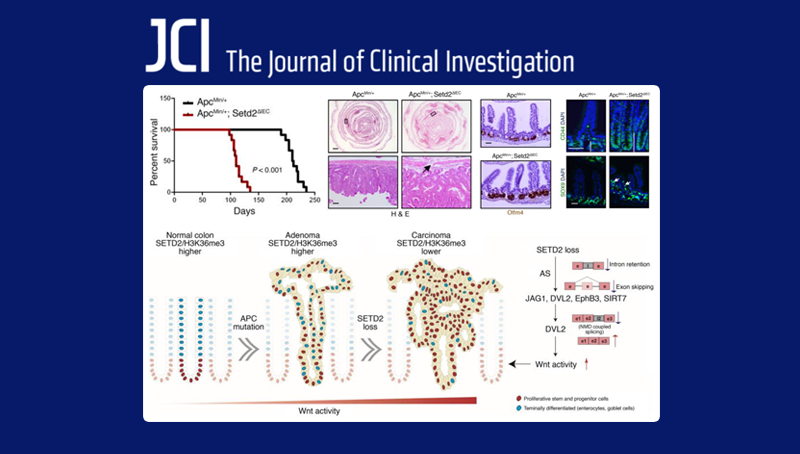 中國科學(xué)院上海營(yíng)養與健康研究院科研人員揭示組蛋白H3K36三甲基轉移酶SETD2在腸癌中的重要功能及調控機制