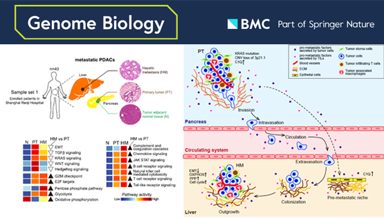 李虹、李亦學(xué)研究組合作破譯胰腺癌肝轉移的分子特征
