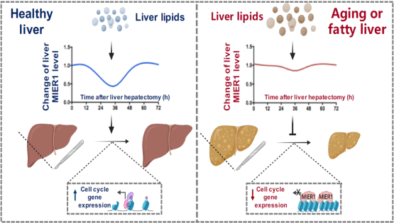 營(yíng)養與健康所丁秋蓉研究組發(fā)現肝臟再生過(guò)程中肝臟脂質(zhì)動(dòng)態(tài)變化信號轉變?yōu)樵偕迯托盘柕年P(guān)鍵“橋梁”因子